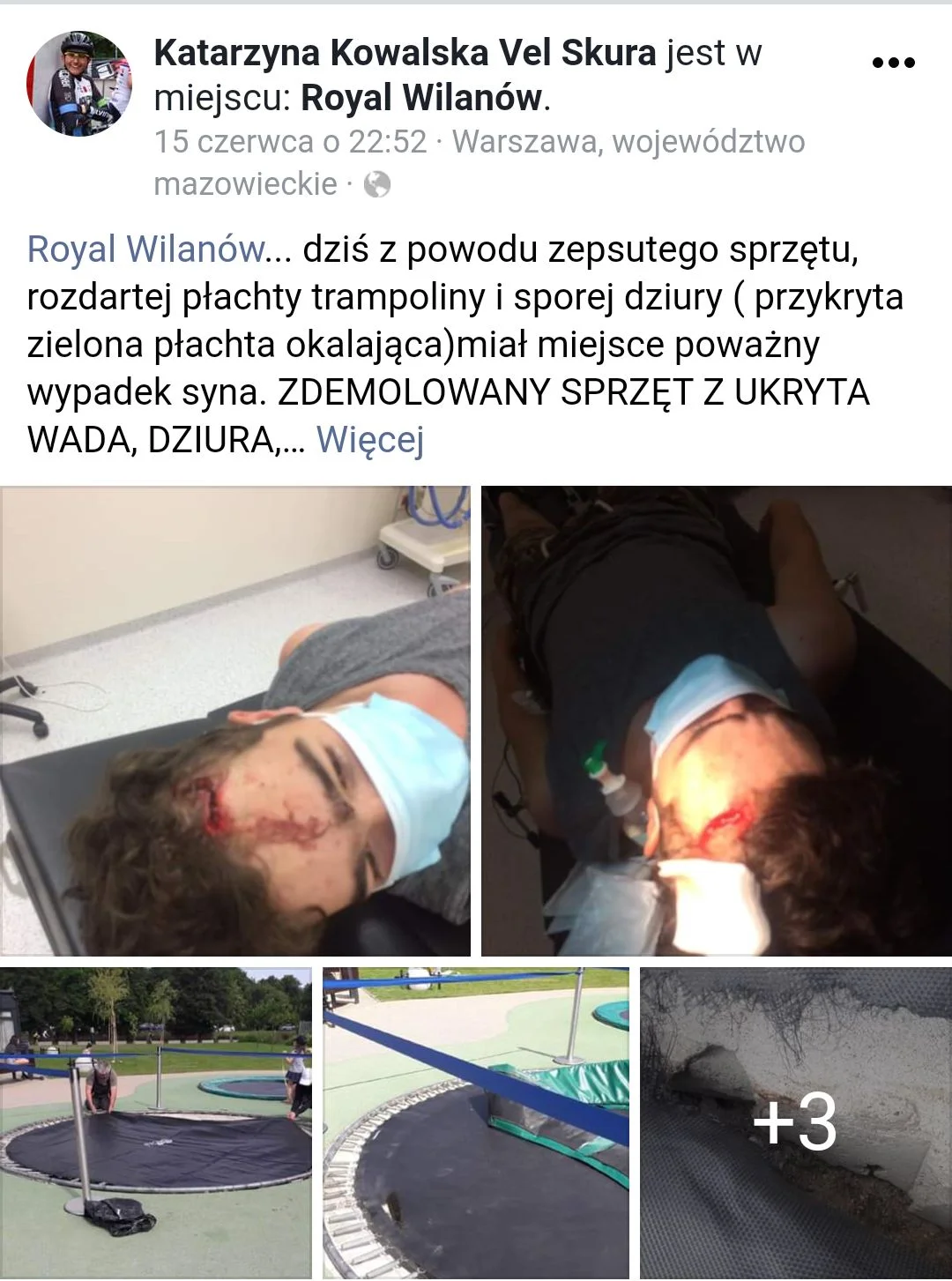 Syn pani Katarzyny trafił do szpitala z rozciętą głową.
