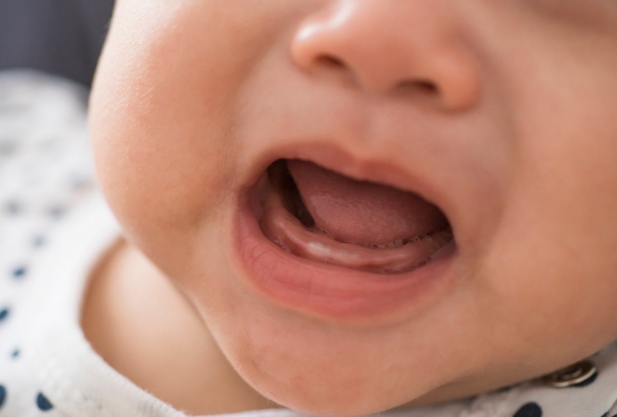 dziąsła niemowlaka podczas ząbkowania