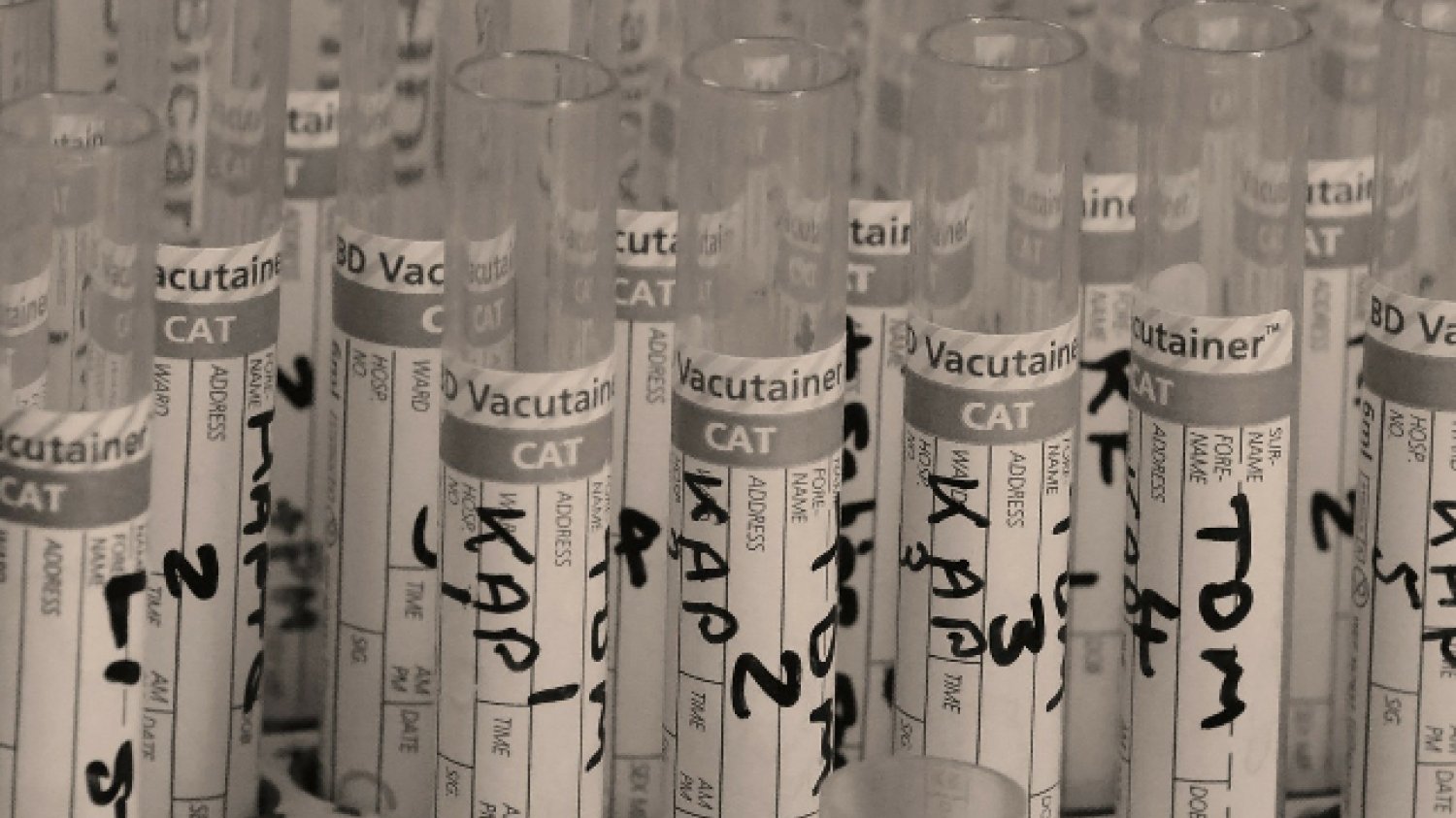 Fot. Pixabay / [url=https://pixabay.com/pl/badanie-rura-laboratorium-214244/] PublicDomainPictures [/url] / [url=https://pixabay.com/pl/service/terms/#usage] CC0 Public Domain [/url]