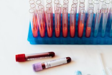 morfologia krwi – neutrocyty morfologia krwi – neutrocyty