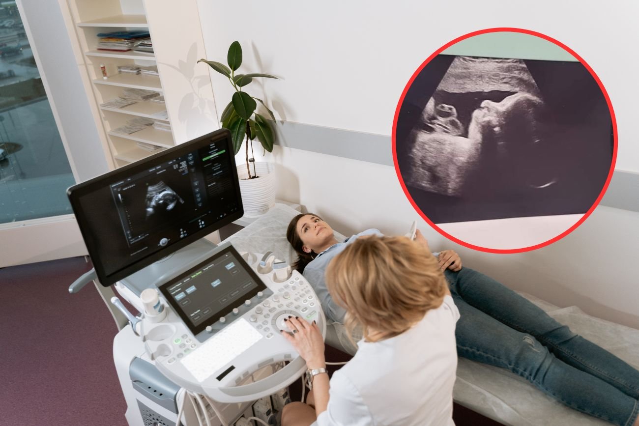 Kobieta podczas badania USG w ciąży.