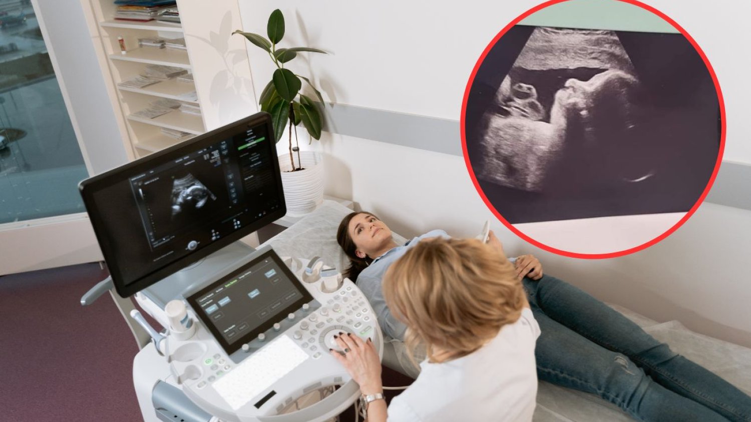 Kobieta podczas badania USG w ciąży.