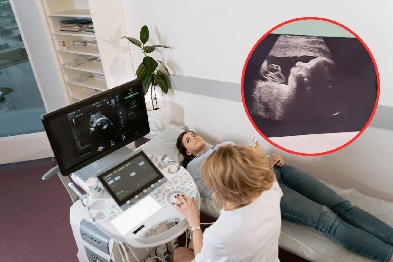 Kobieta podczas badania USG w ciąży.