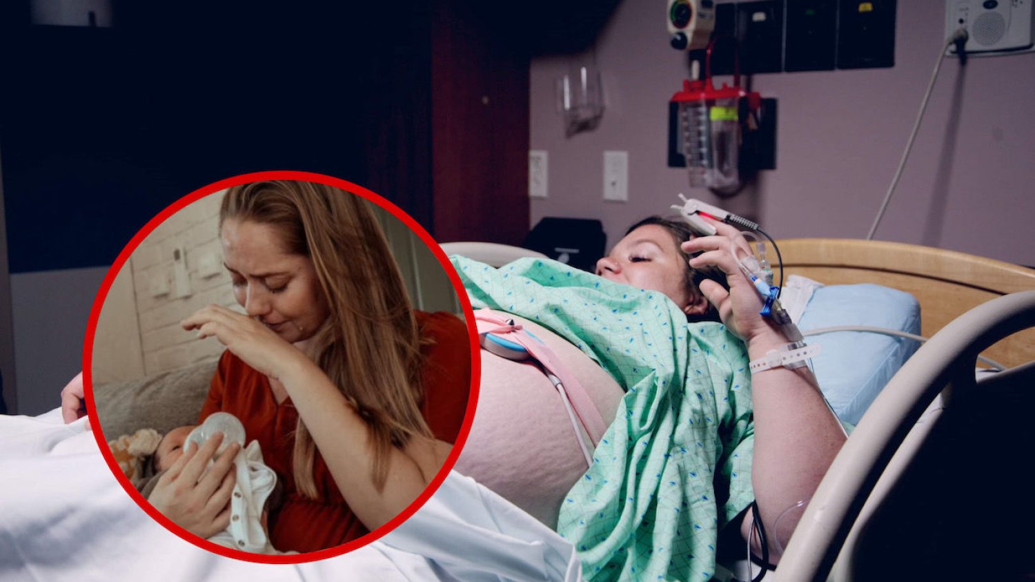 Nietypowy kolor siary w 33 tygodniu ciąży okazał się nowotworem
