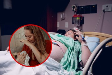Nietypowy kolor siary w 33 tygodniu ciąży okazał się nowotworem