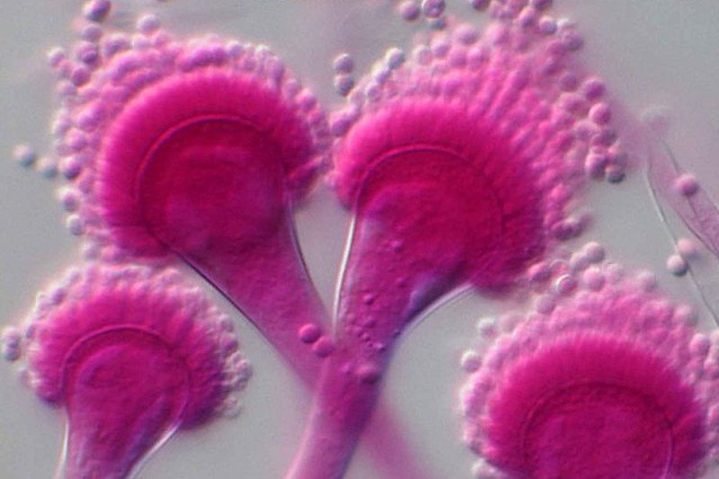 Aspergillus fumigatus