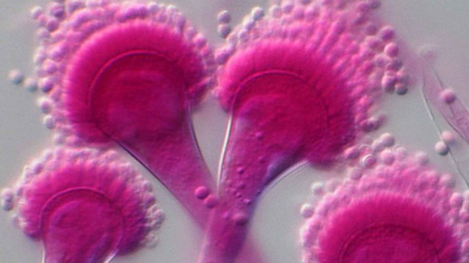 Aspergillus fumigatus