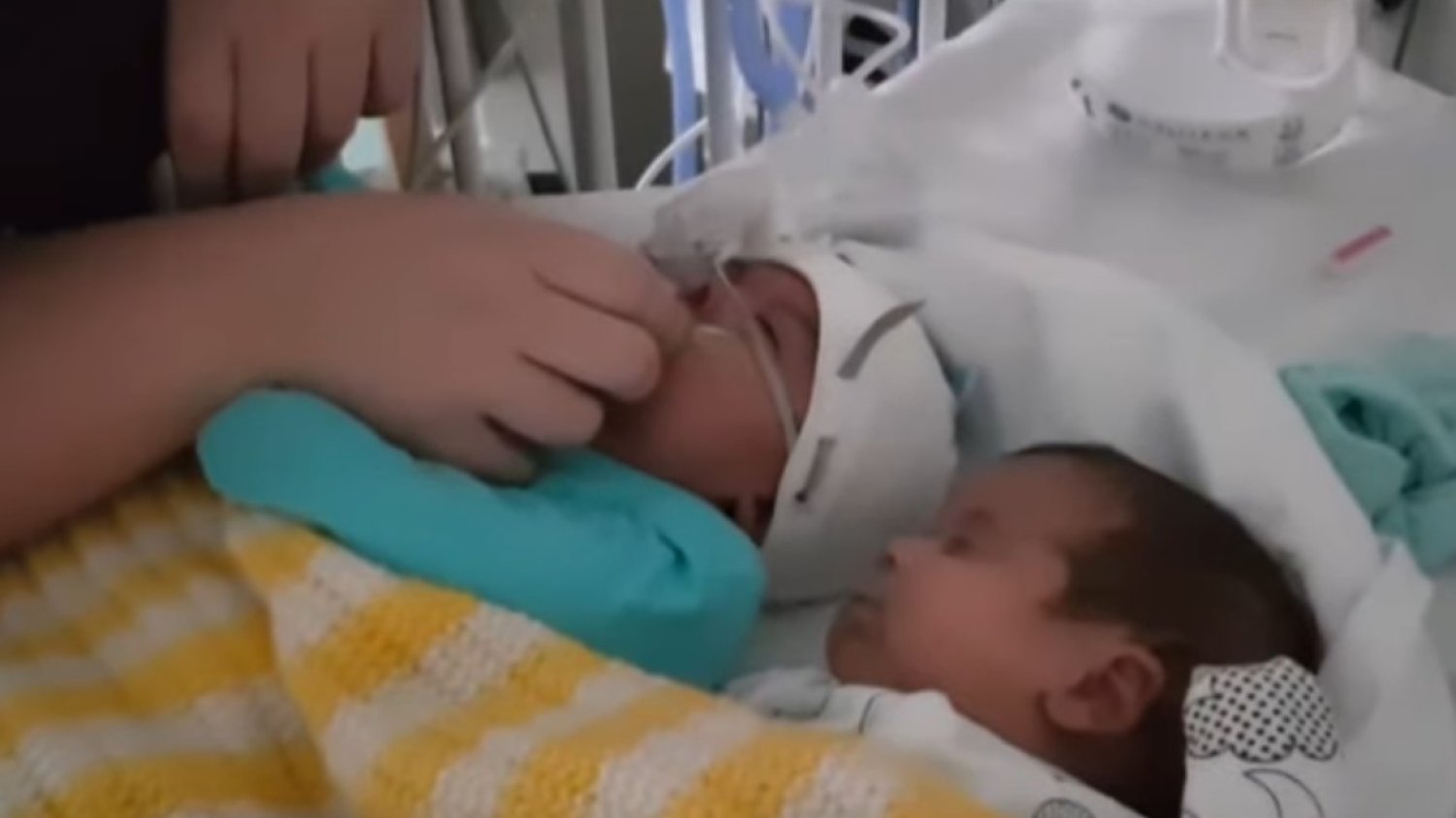 Obecność brata bliźniaka uratowała życie przedwcześnie urodzonemu Deiniol'owi