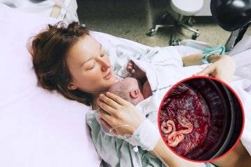 Kobieta trzyma po porodzie noworodka na piersi.