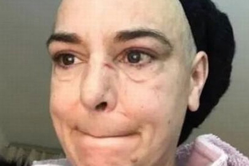 Sinead O'Connor została pobita przez syna.