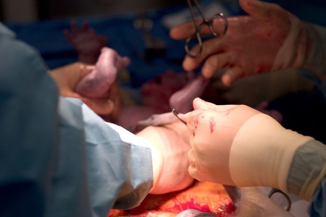 Prawo autorskie: vividpixels / 123RF Zdjęcie Seryjne