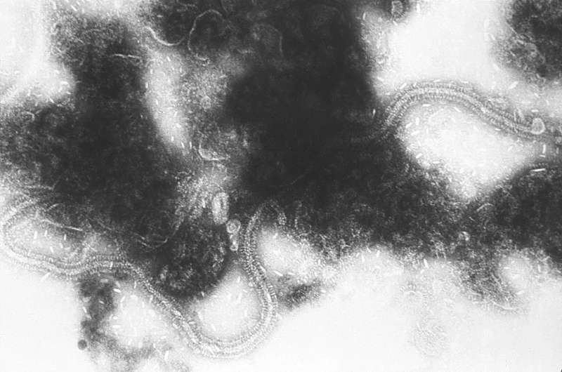 Wirus RS (syncytialny wirus nabłonka oddechowego, RSV) to najczęstsza przyczyna zakażeń dolnych dróg oddechowych u niemowląt i małych dzieci. Na zdjęciu obraz wirusa w elektronowym mikroskopie transmisyjnym