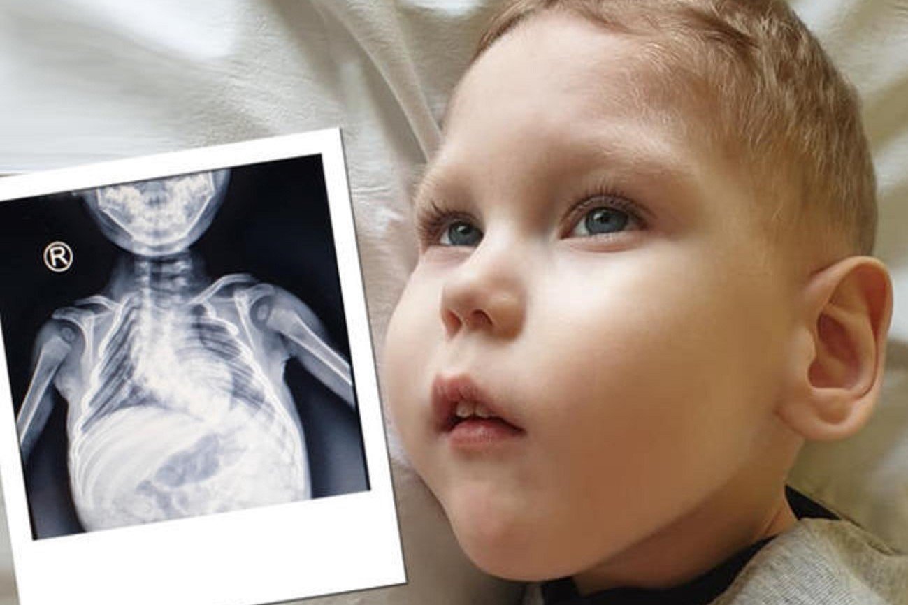 Kubuś potrzebuje pomocy.