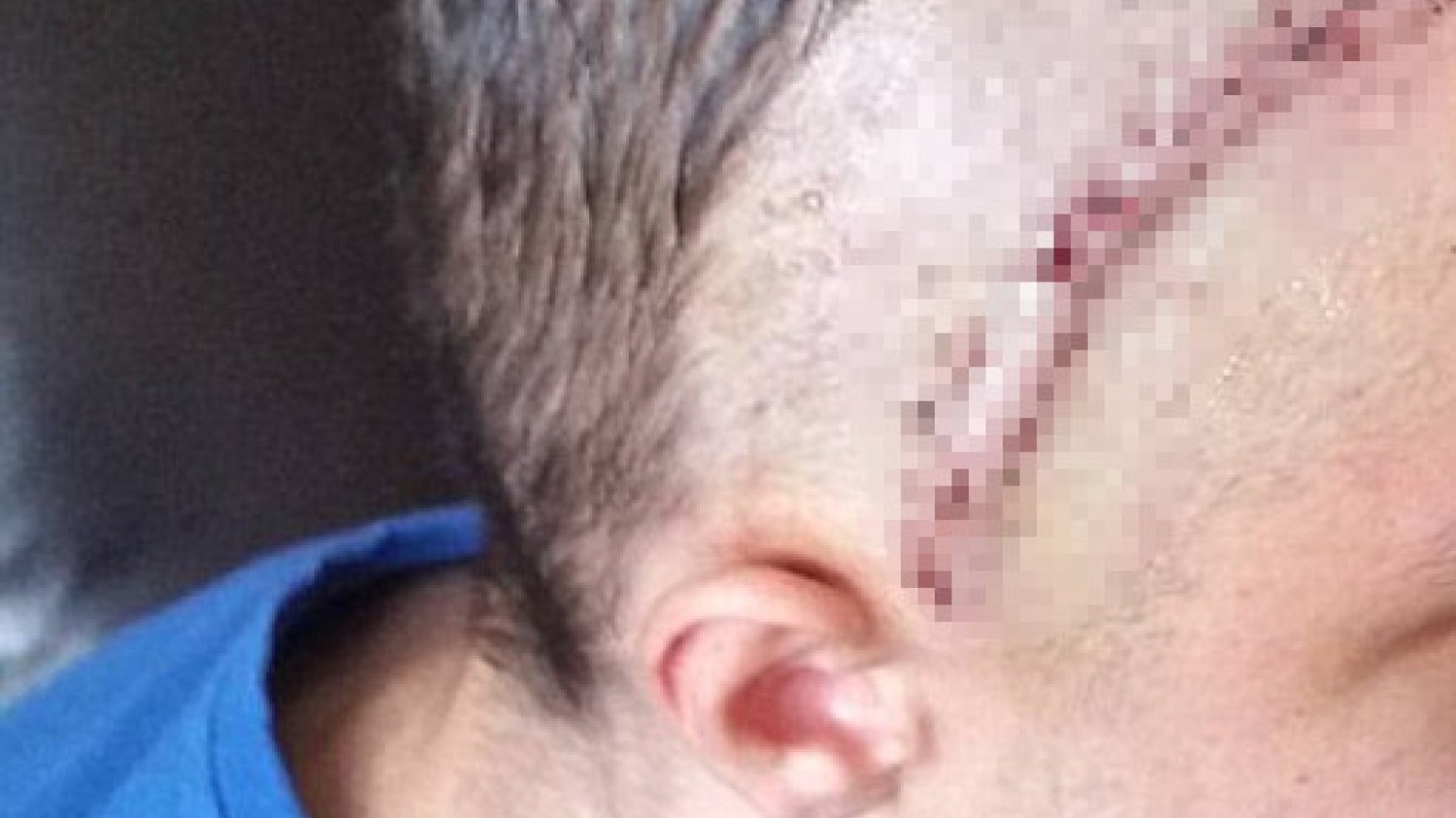Kask chroni nasze zdrowie, a często i ratuje życie