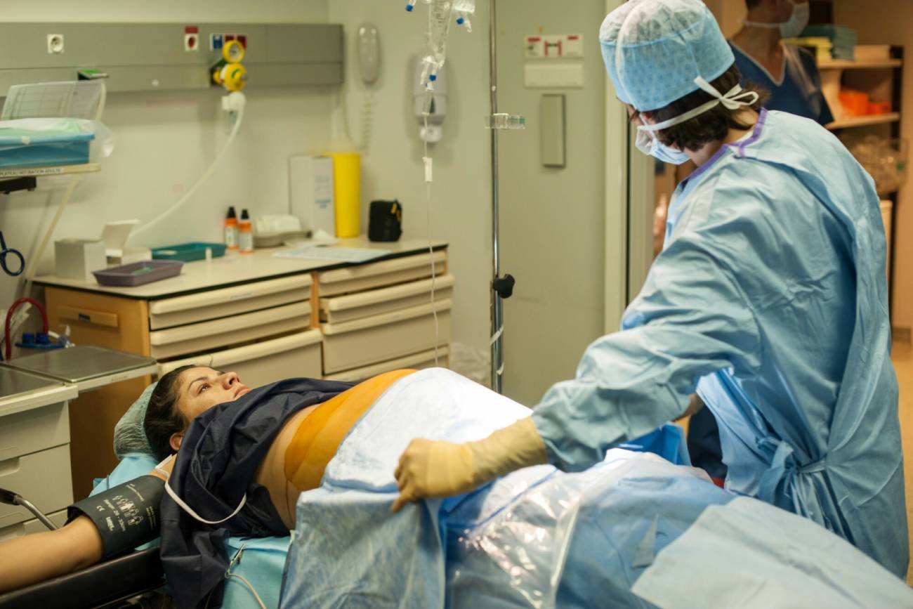 poród brzuszny, francuski poród, francuskie cesarskie cięcie, francuska cesarka, poród cc, poród sn, cesarka i poród naturalny