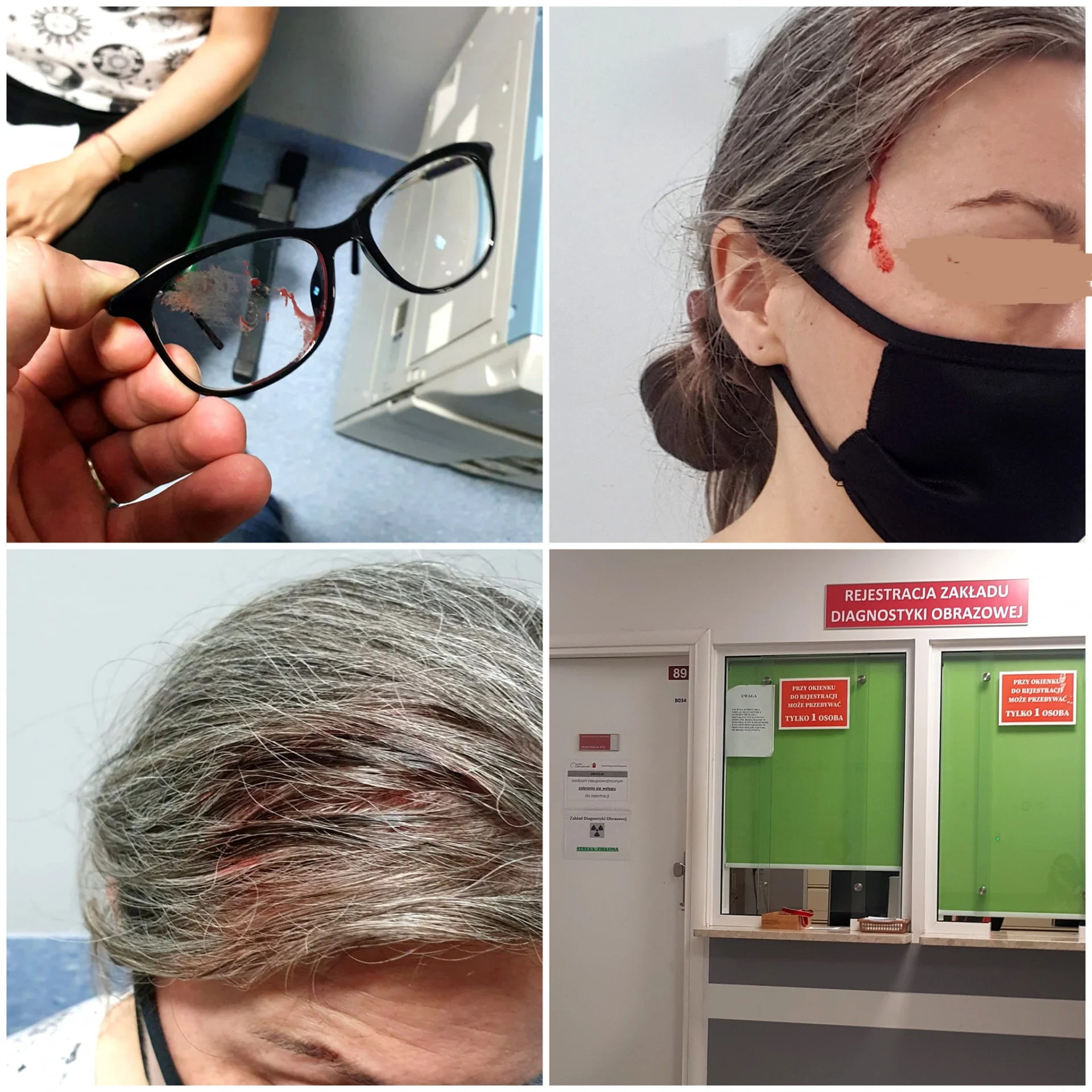 Dzieci ciskały kamieniami w przechodniów. Porażający wpis matki.