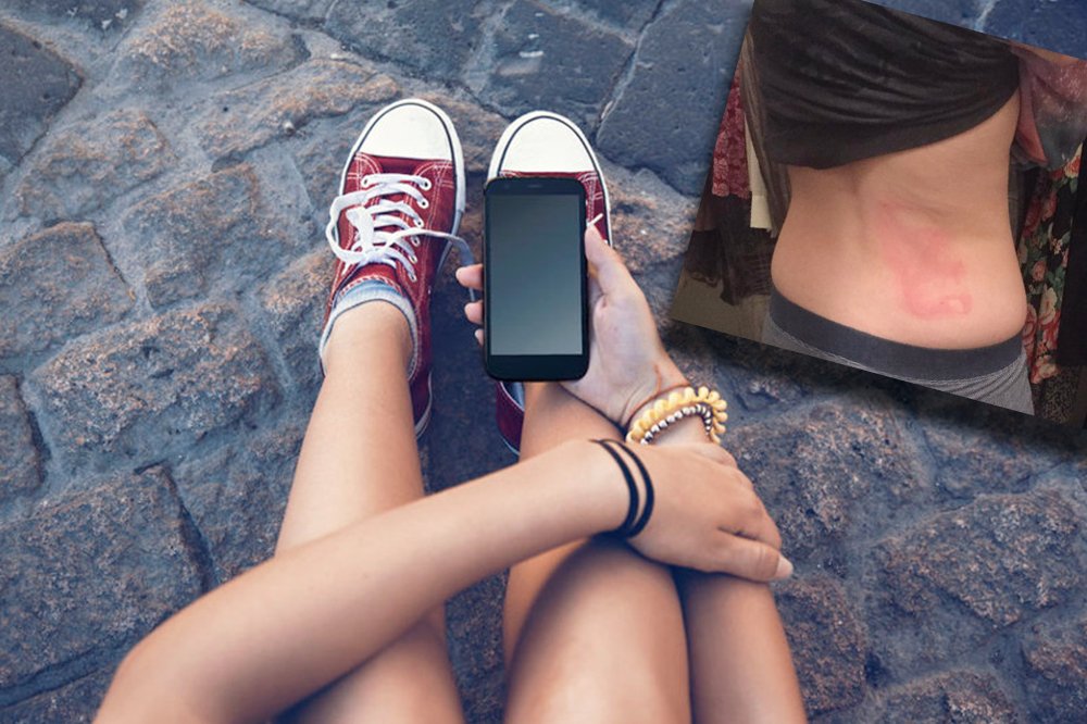 Obudowy telefonów przyczyną bolesnych obrażeń.