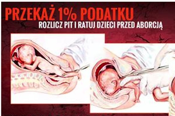 Screen z Facebooka / [url=https://www.facebook.com/FundacjaPro/photos/a.10150241757838631.337524.300745193630/10153982920408631/?type=3&theater] Fundacja Pro - Prawo do Życia [/url]