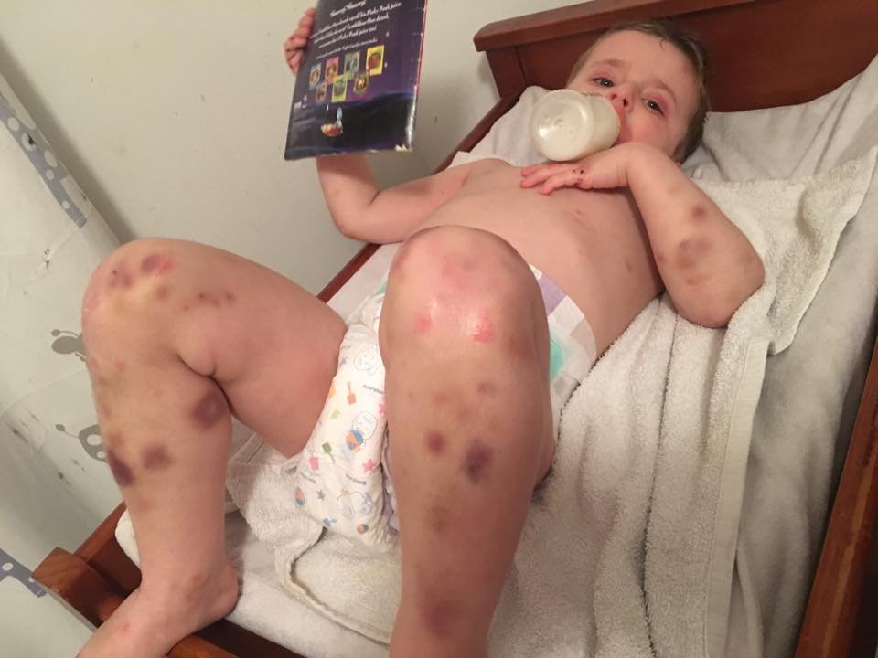 Rodzice Fletchera starają się o dziecko, by uratować życie starszego syna.