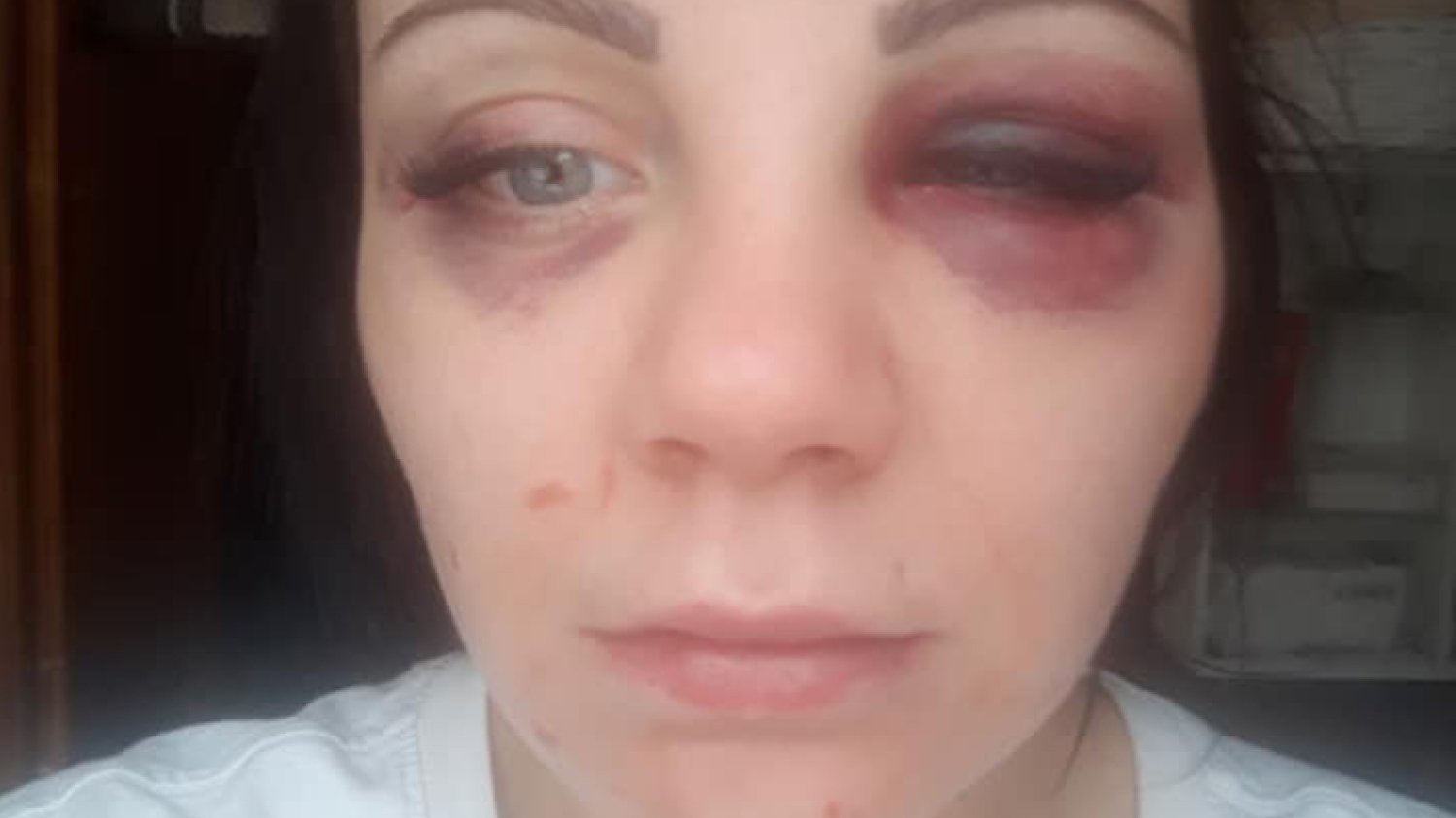 Tak wygląda pani Martyna po pobiciu przez jednego sprawcę – męża. Najbardziej przerażająca jest jednak zbiorowa przemoc obserwatorów zdarzenia, którzy popisali się znieczulicą i cynizmem
