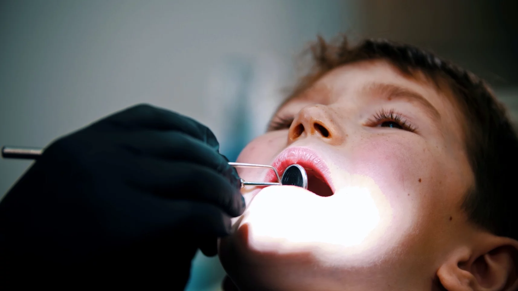 Zespół MIH, czyli hipomineralizacji trzonowców i siekaczy Chłopiec siedzi na fotelu dentystycznym