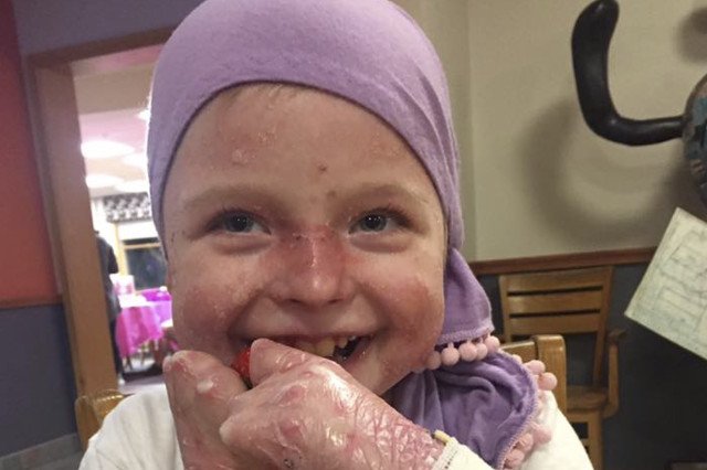 Od kilku miesięcy Zuzia leczona jest w Stanach