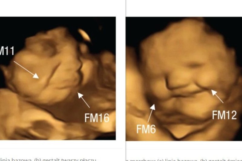 Co jeść w ciąży? Naukowcy sprawdzili, jak płód reaguje na warzywa