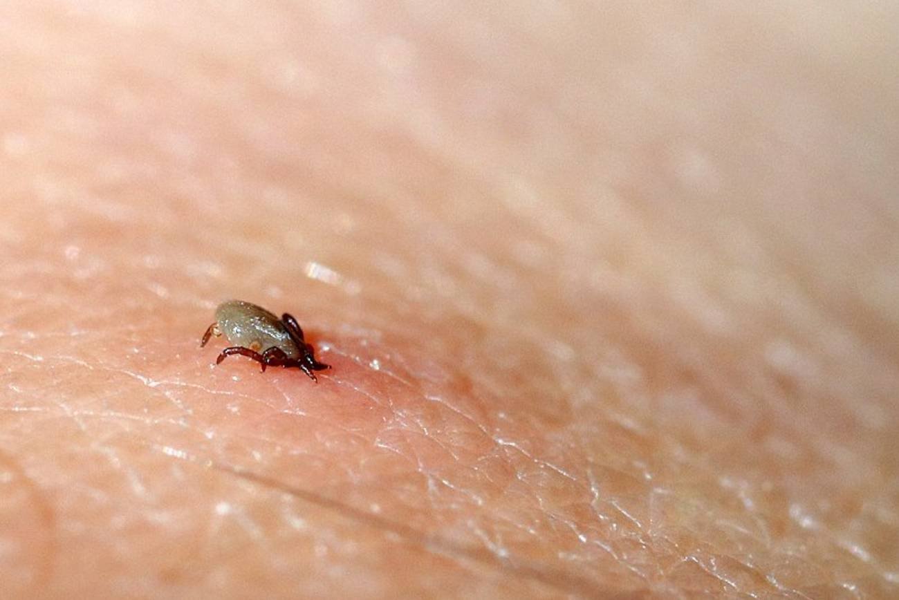 Dziecko ugryzł owad lub kleszcz? Ten trik z długopisem może uratować jego zdrowie