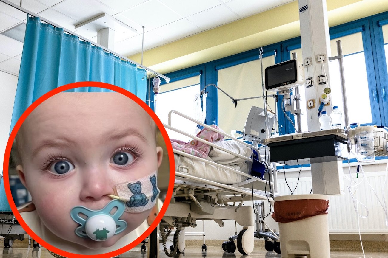 Białaczka limfoblastyczna: siniaki Białaczka limfoblastyczna: siniaki