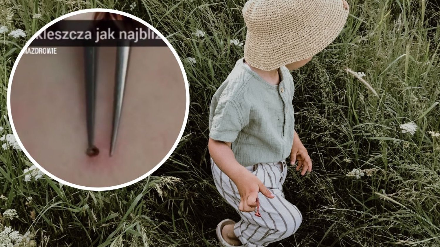 Chłopiec spaceruje po łące, na której mogą być kleszcze.