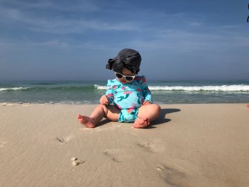 oparzenia słoneczne u dzieci: objawy, zdjęcia, jak wyglądają, jakim kremem smarować, jaka maść na oparzenia, domowe sposoby na oparzenia słoneczne.