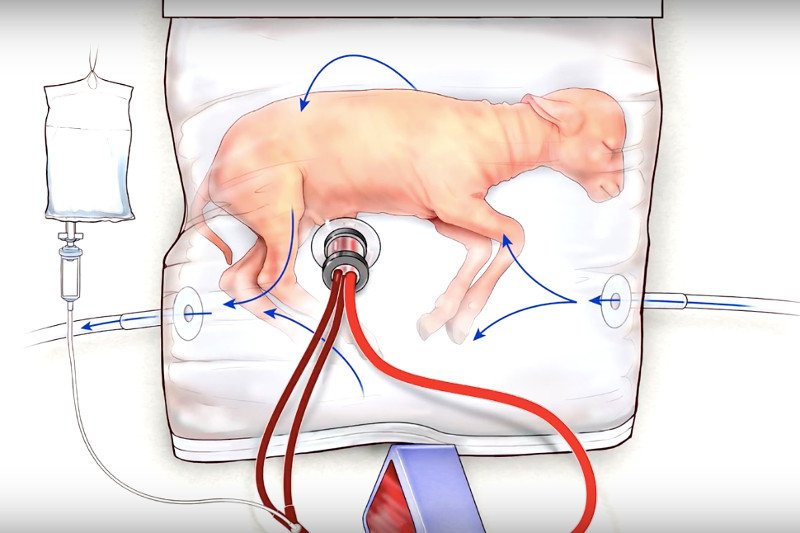 Wyniki eksperymentu pozwalają myśleć o kolejnych krokach postępu w ratowaniu ekstremalnych wcześniaków.