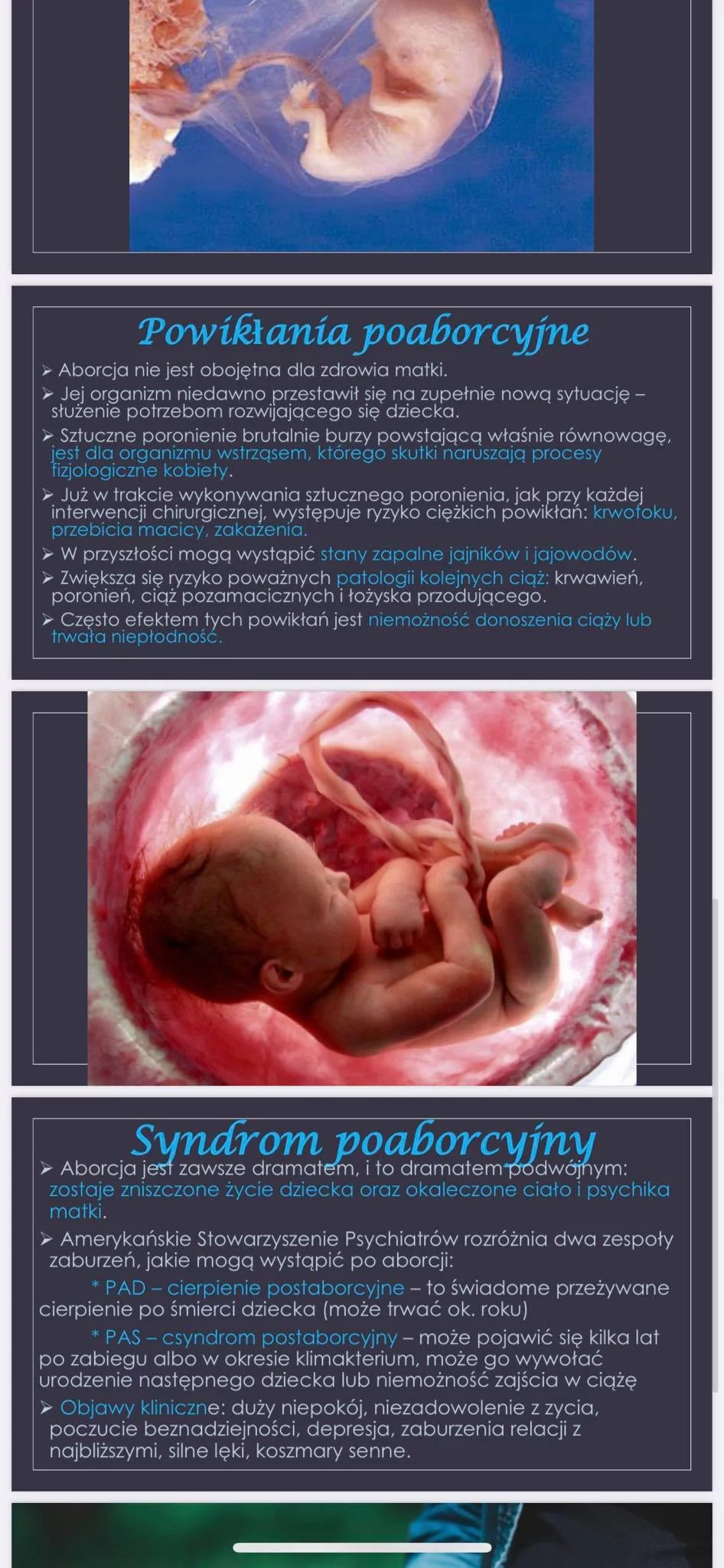 Dziecko nie w porę. Problem Aborcji