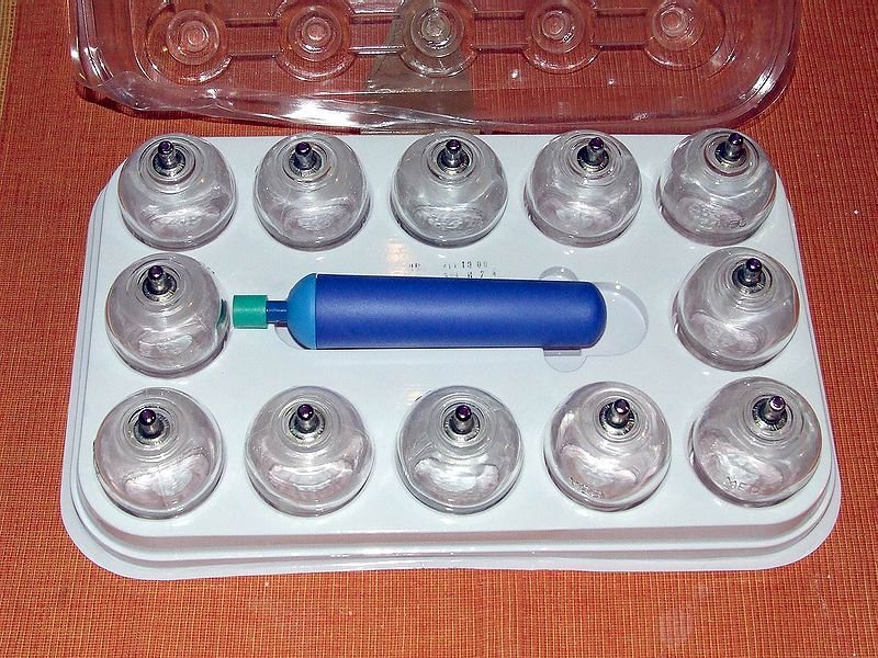 Stawianie baniek u dzieci: Jak to zrobić? (Bańki sposobem na