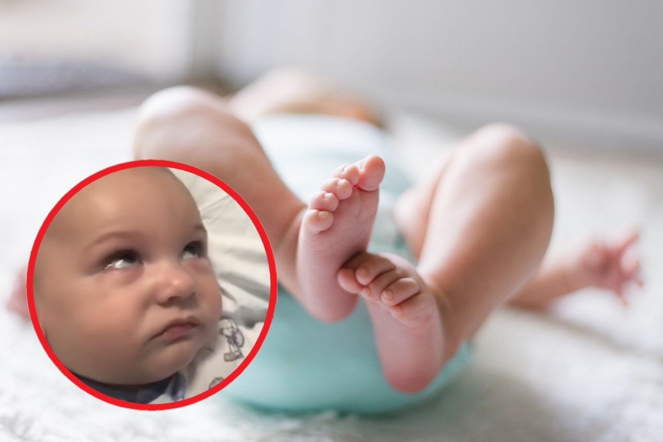 objawy padaczki u dziecka