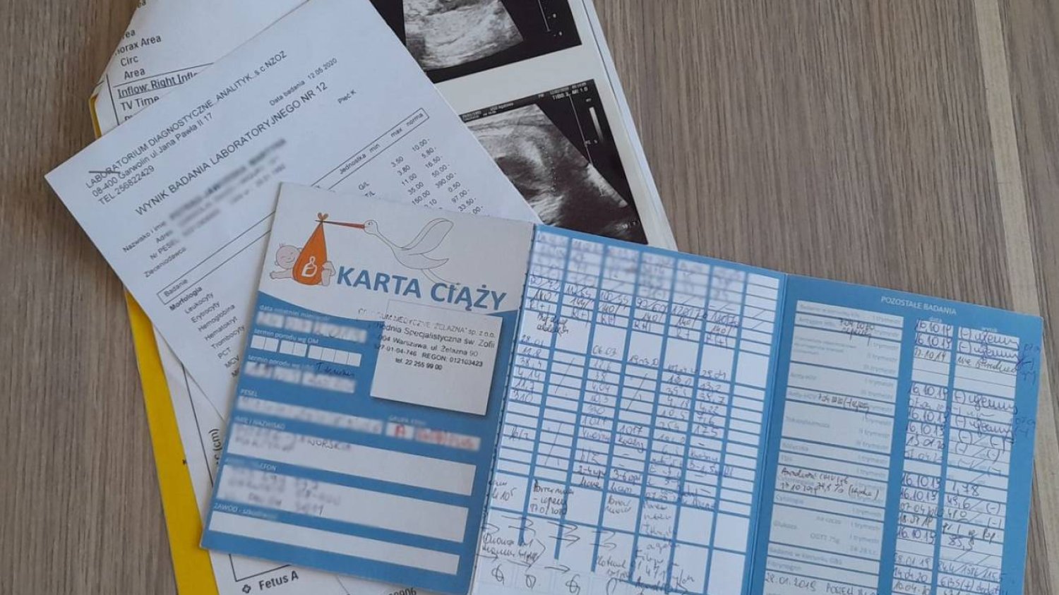 karta ciąży, co to jest, jak wygląda, jakie informacje w karcie ciąży, kiedy lekarz zakłada kartę ciąży, najważniejsze skróty w karcie ciąży