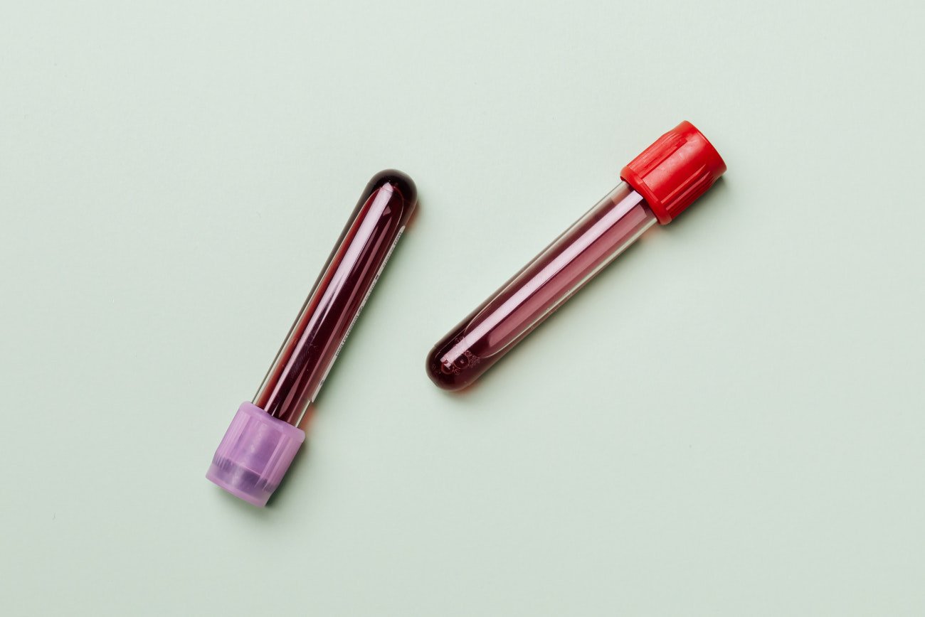 Badanie krwi – monocyty