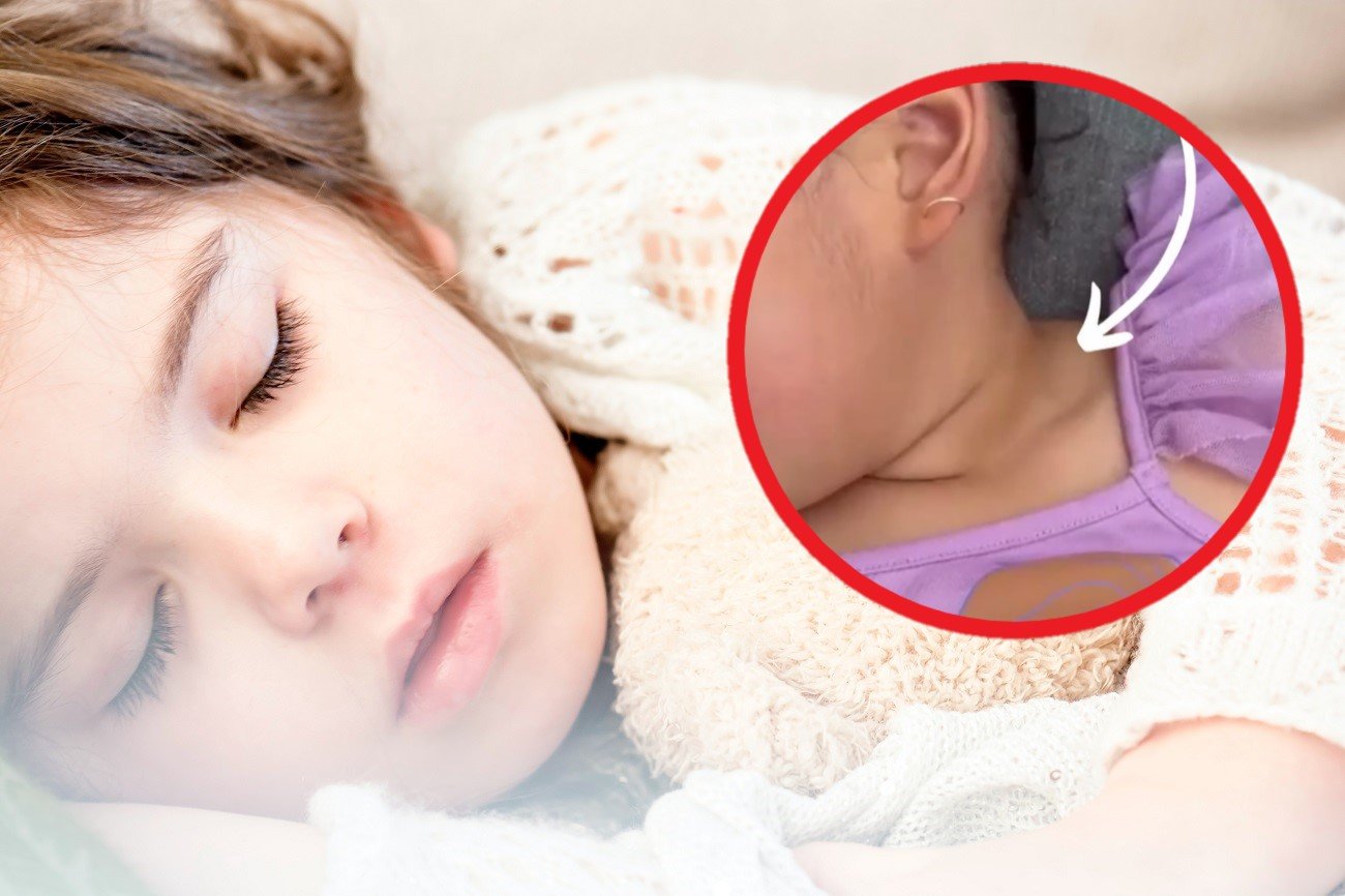 niewydolność oddechowa u dziecka