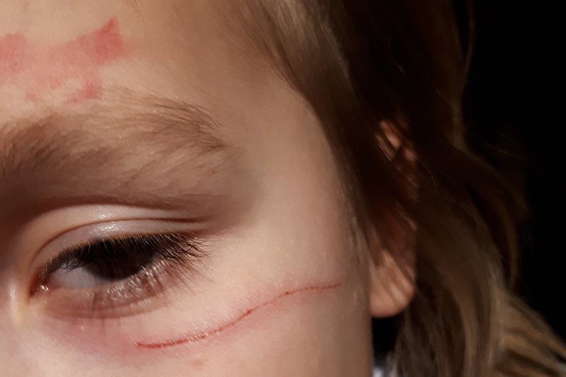 5-latek nadział się na drut, który wystawał na boisku