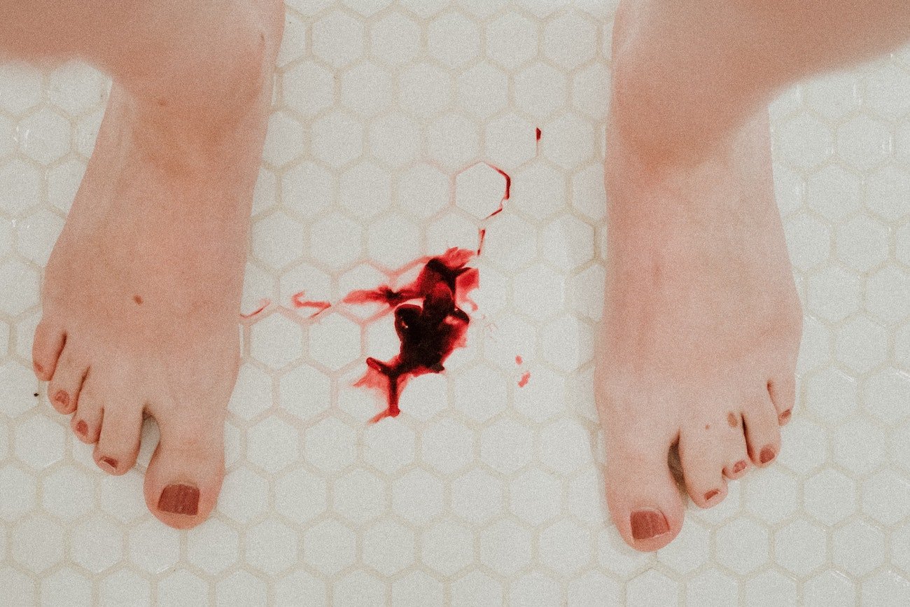 W XXI w. w szpitalach nie wiedzą, iż kobiety mają miesiączkę. Krwawisz? Radź sobie sama