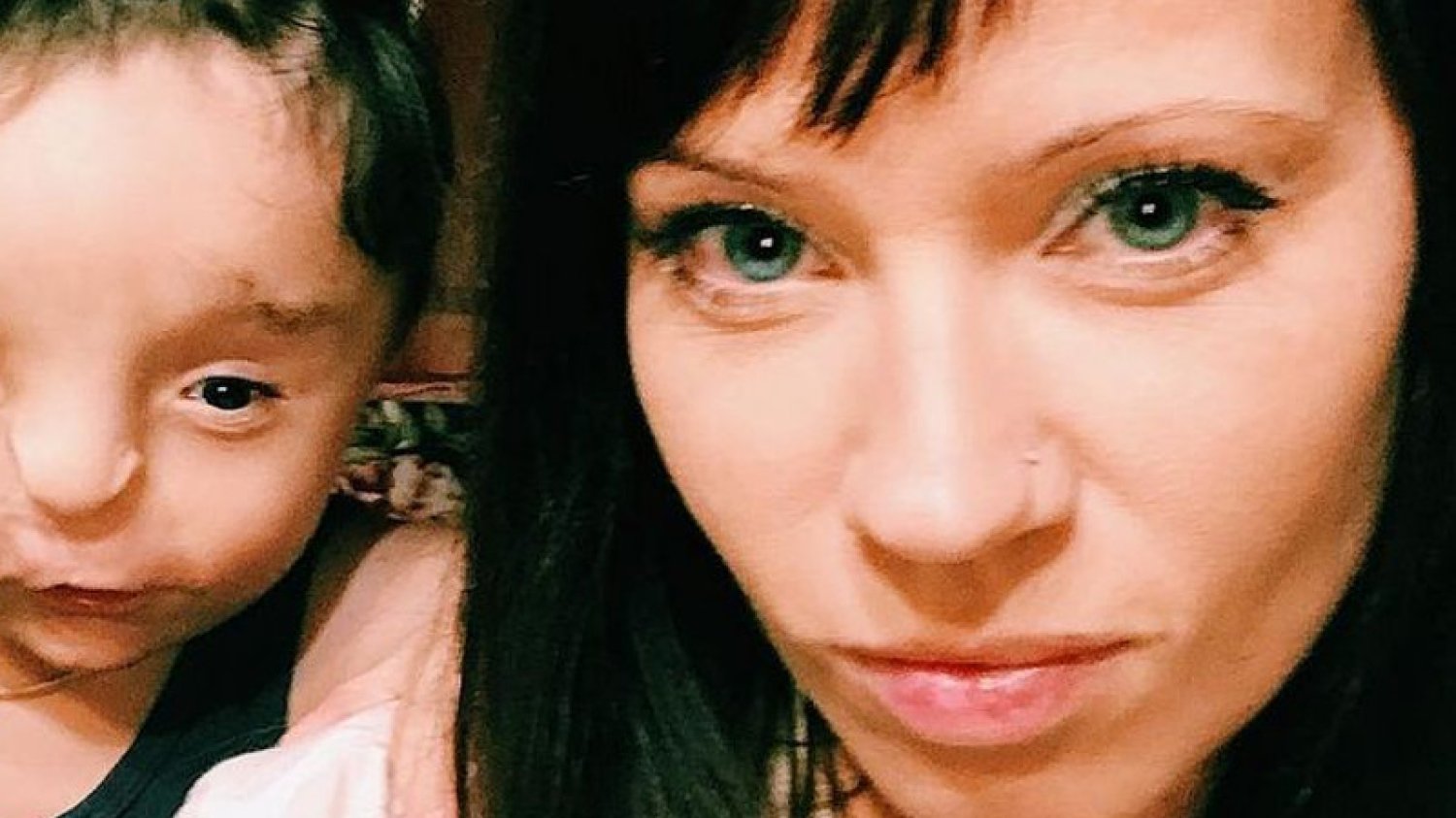 Chłopca nazywano potworem. Nika postanowiła zostać jego mamą