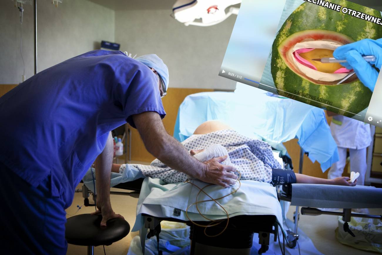 cesarka, cięcie cesarskie, cc, jak wygląda cesarka, jak wygląda cc, film z cięcia cesarskiego, zabawny film