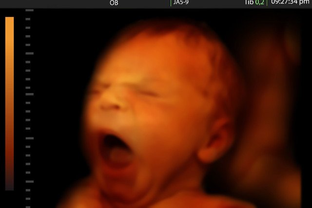 Płód w 6 miesiącu ciąży.