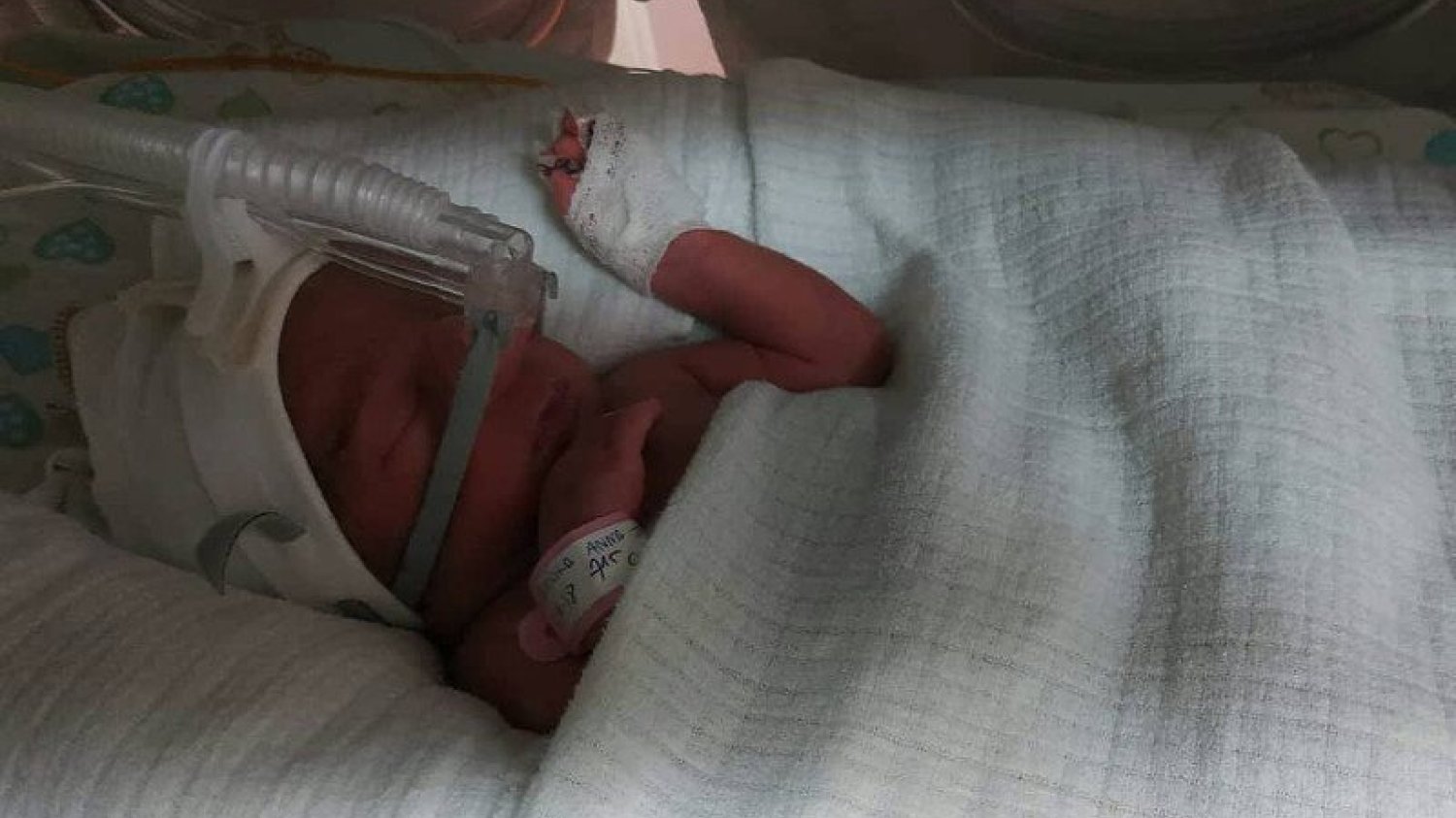 Jednojajowe trojaczki urodziły się w Gdańsku