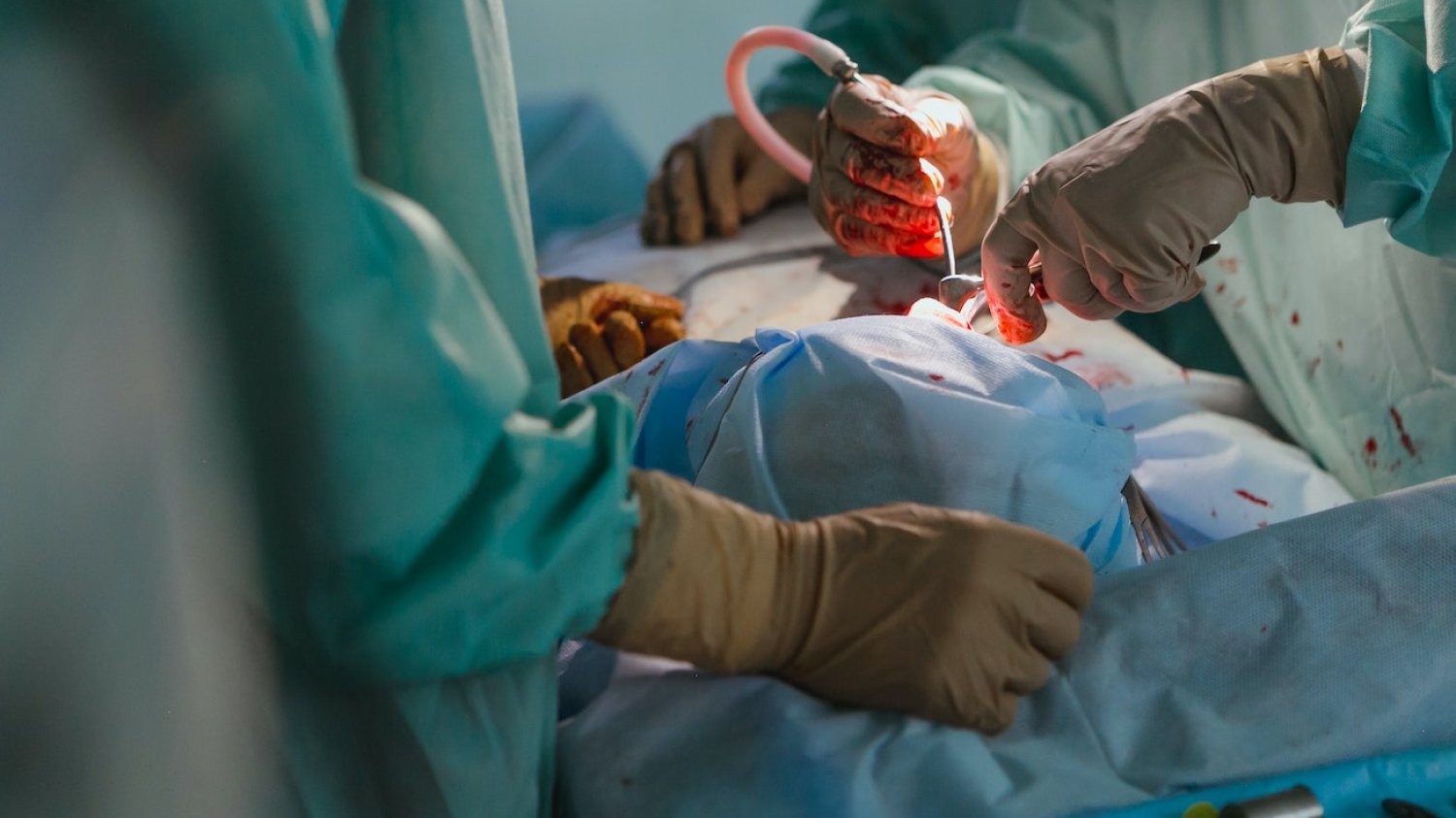 Neuroblastoma u dzieci: objawy, leczenie