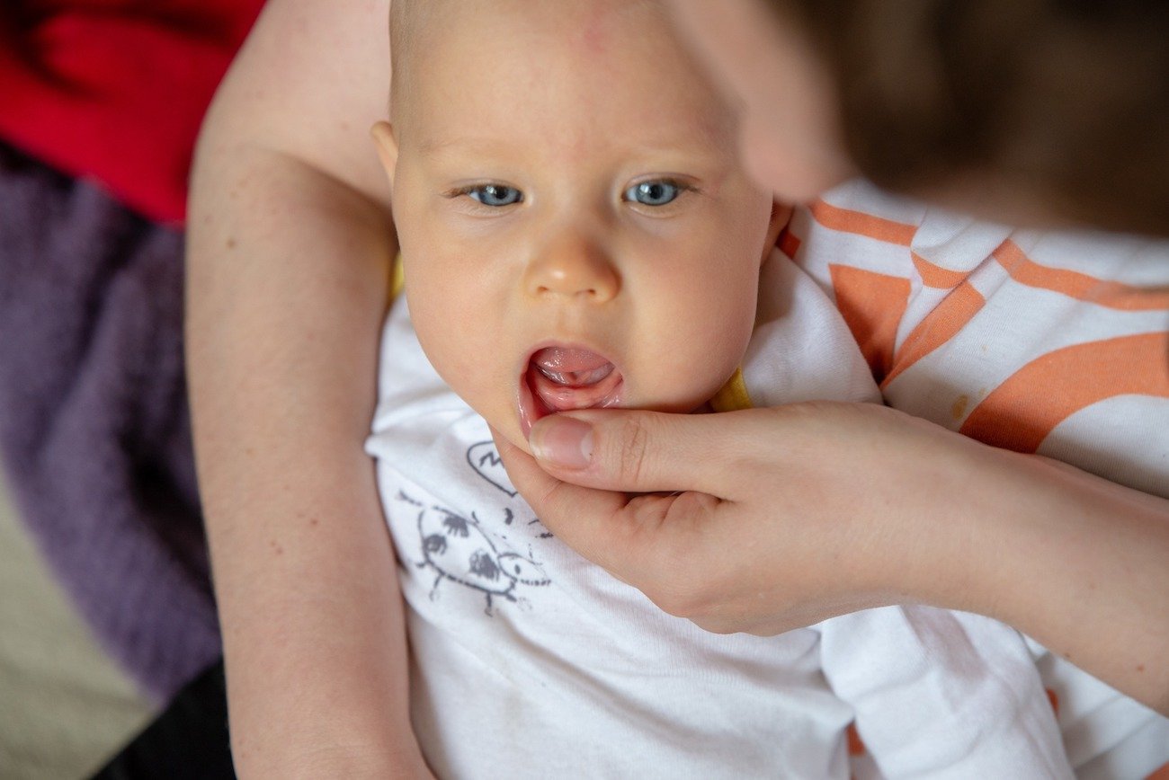 tak wyglądają dziąsła przy ząbkowaniu (zdjęcie)