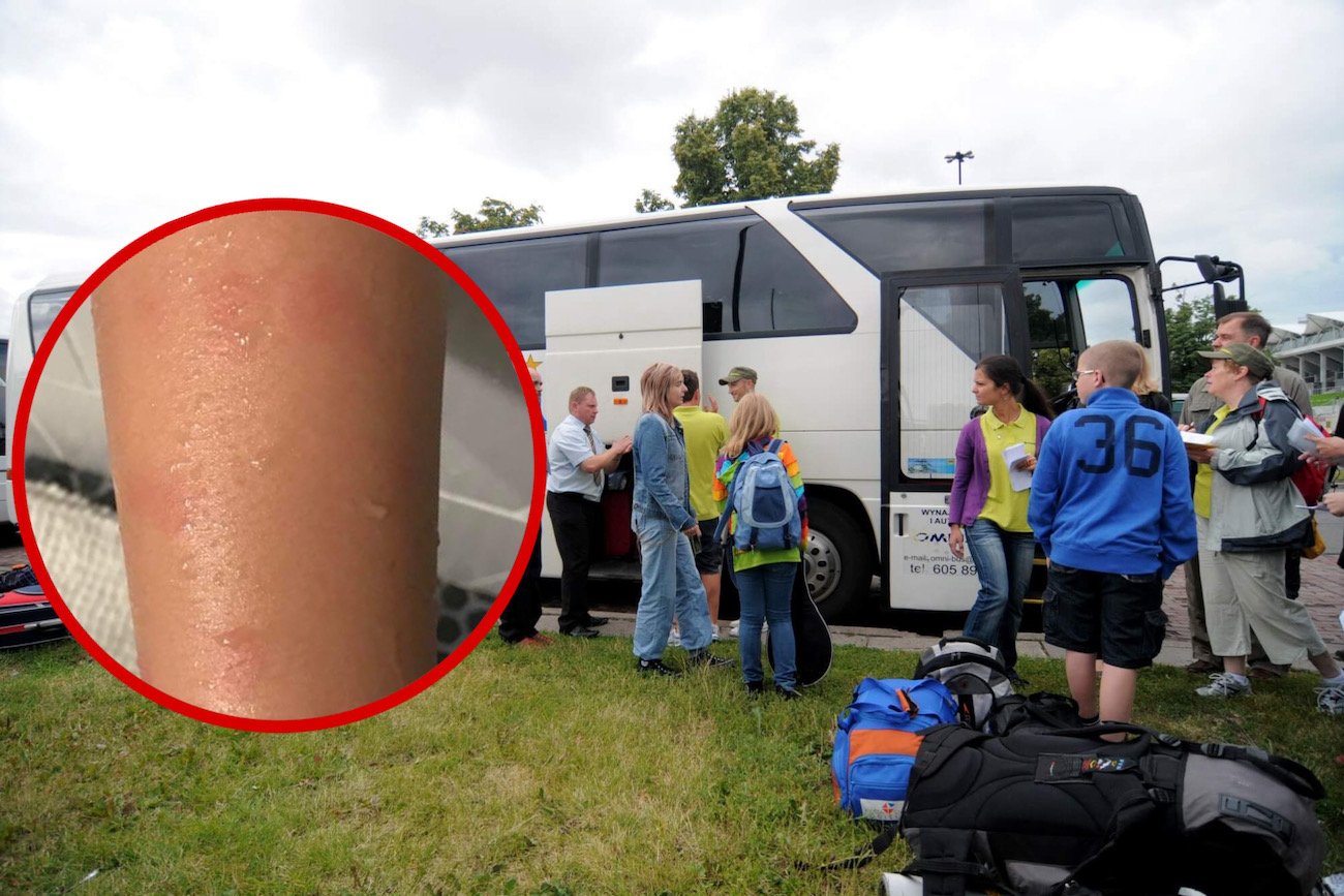 ugryzienia pluskiew na koloniach