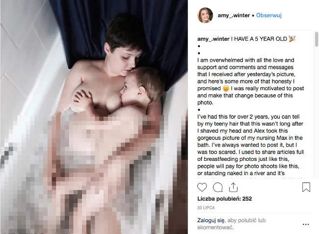 To zdjęcie wywołało wiele kontrowersji