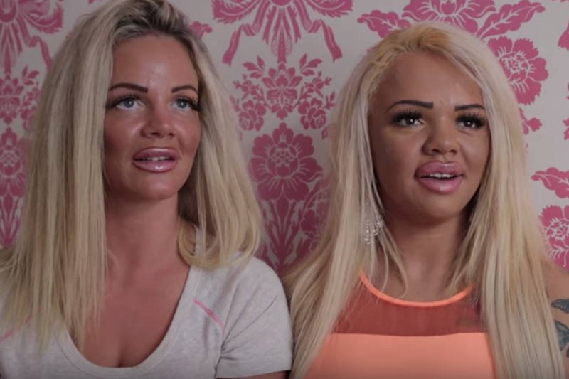 Podobne jak dwie krople...kwasu hialuronowego i plastiku. Poznajcie Georginę i Kylę