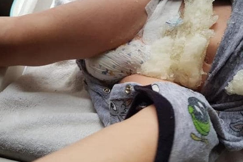 Rodzice zaczęli udostępniać zdjęcia wadliwych pieluch